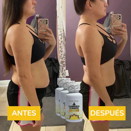 CándidaCleanse™ (60 capsulas) - Estomago Ligero
